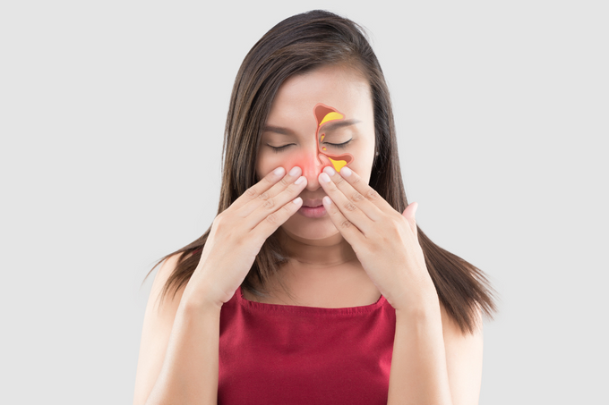 नेज़ल पॉलिप्स