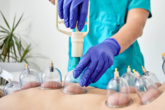 Cupping Therapy for Asthma: A Natural Approach to Better Breathing