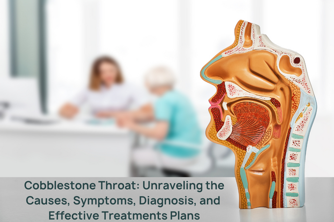 Cobblestone Throat: Unraveling the Causes, Symptoms, Diagnosis, and Effective Treatments Plans